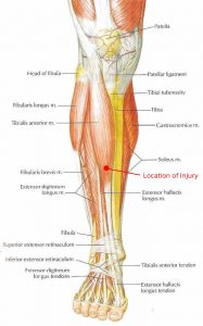 lowerlegmuscles